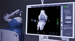 3d image of a knee joint